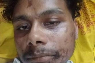 ५ लाख खर्चेर दुबई पुगेका सन्तोष : काम माग्दा यातना, तातो दाल मुखमा झोसियो